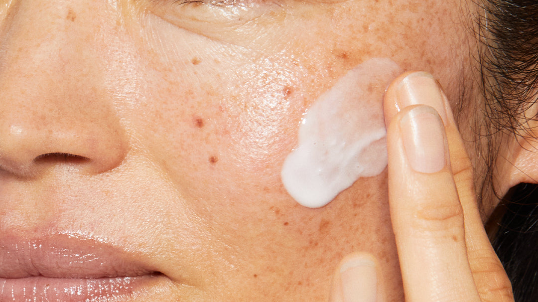 hudtype og hudtilstand