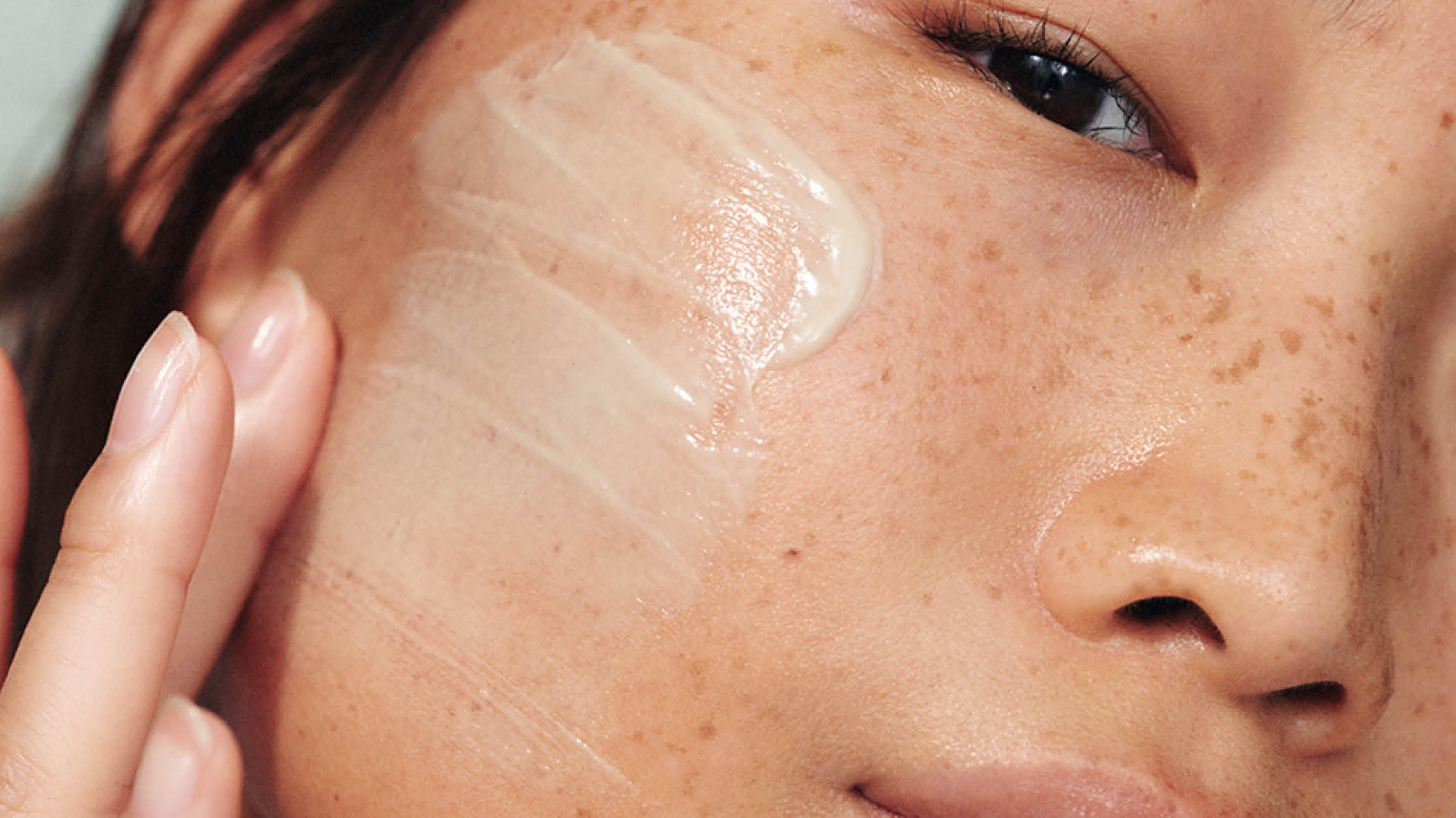 hvordan synlig løfte hyperpigmentering