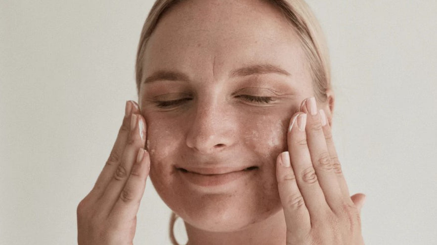 ung hud kan være en utfordring. her er noen tips.