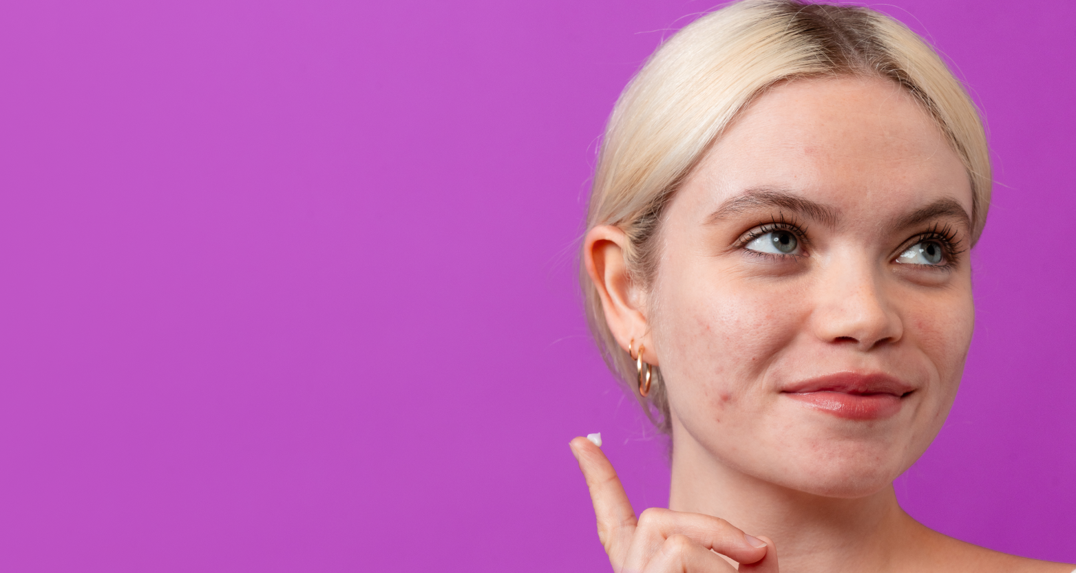 hva er kviser, og hvorfor får man dem?