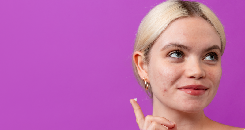 hva er kviser, og hvorfor får man dem?